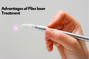 Advantages of Piles  laser Treatment with Precision Technology