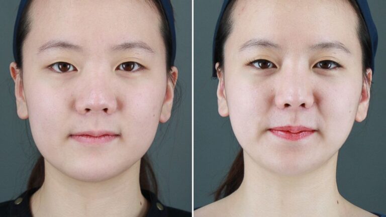 South Korea Plastic Surgery Market Challenges and Opportunities, Key Industry Players and Market Forecast-2032