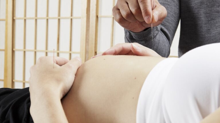 acupuncture for pregnancy in London