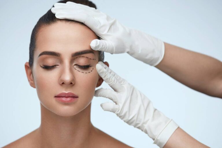 The Eyelid Surgery Procedure Step-by-Step Guide