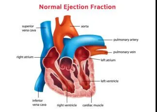 Normal Ejection Fraction by Age