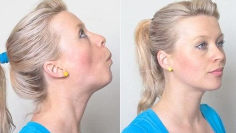 Rid Of Neck Fat
